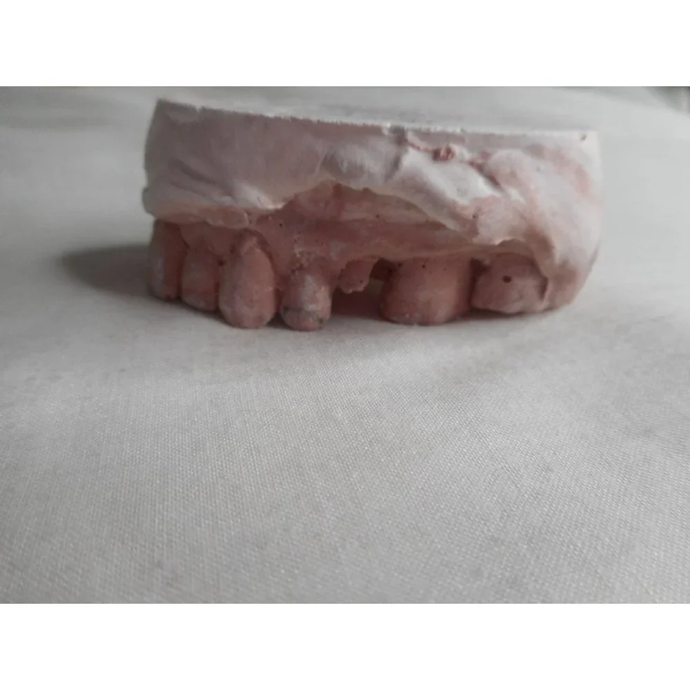 Vintage Cast Dental Teeth Mold Tooth Castings #11 - Picture 4 of 5